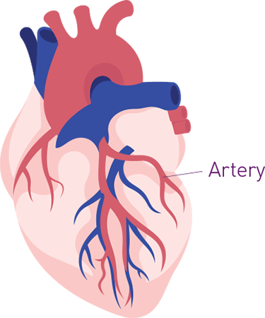 Your heart has three major arteries where a heart attack can occur.